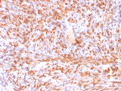 Formalin-fixed, paraffin embedded human uterus sections stained with 100 ul anti-Calponin-1 (clone rCNN1/832) at 1:300. HIER epitope retrieval prior to staining was performed in 10mM Tris 1mM EDTA, pH 9.0.